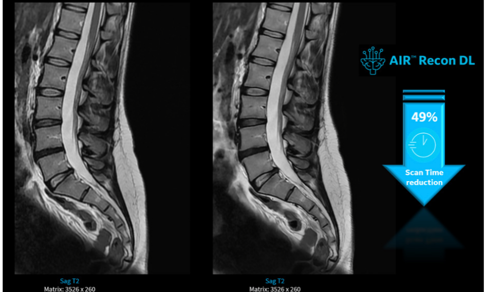 Jornada de IA e ecossistema digital em radiologia: como oferecer alta produtividade com qualidade de maneira sustentável Melhorando a experiência do paciente em um serviço de radiologia.